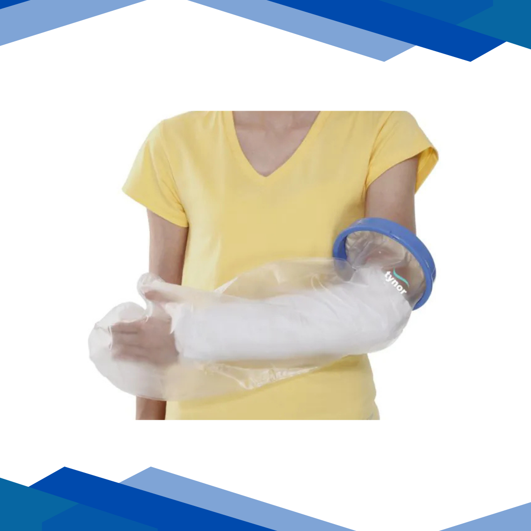 Cast-Cover-Arm
